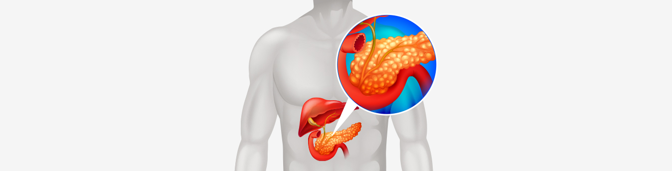All you need to know about Pancreatitis