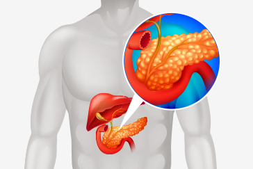 All you need to know about Pancreatitis