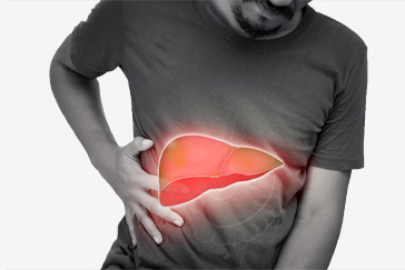 Common Conditions that can Lead to Liver Failures in Adults