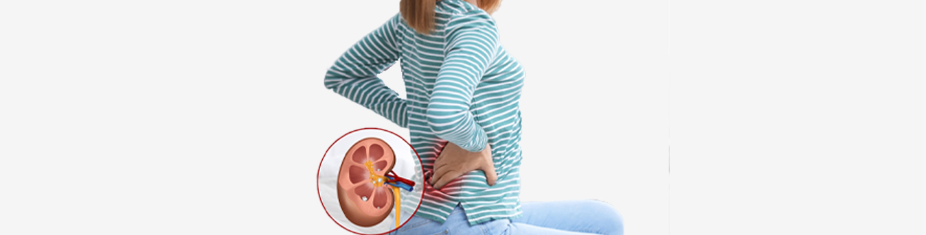 Home remedies that can help you get rid of Kidney stones naturally