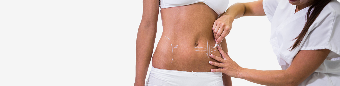 Liposuction for weight loss: Is it really effective?