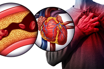 Coronary Artery Disease: Is your heart as healthy as you think?