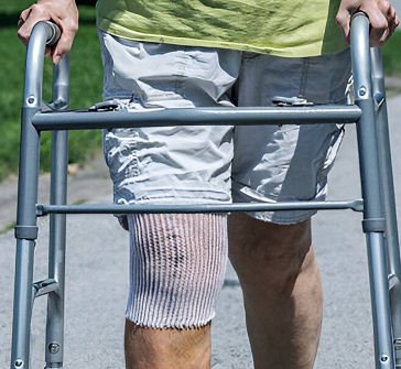 Knee Replacement Surgery: Is It Time for You to Consider It?