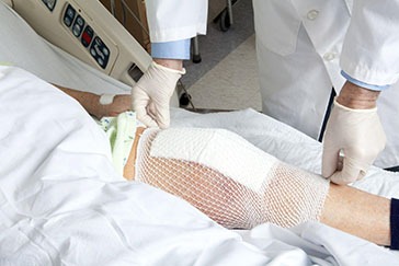Factors To Consider Before Opting for Knee Surgery
